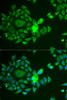 Cell Biology Antibodies 4 Anti-NDUFS4 Antibody CAB13519