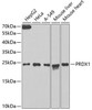 Cell Biology Antibodies 4 Anti-PRDX1 Antibody CAB13524