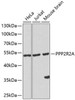 Cell Biology Antibodies 4 Anti-PPP2R2A Antibody CAB13530