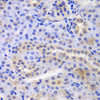Cell Biology Antibodies 4 Anti-PSMA6 Antibody CAB13536