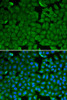 Cell Biology Antibodies 4 Anti-SPINK1 Antibody CAB13546