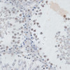 Cell Biology Antibodies 4 Anti-USP7 Antibody CAB13565