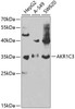 Cell Biology Antibodies 4 Anti-AKR1C3 Antibody CAB13568