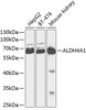 Metabolism Antibodies 1 Anti-ALDH4A1 Antibody CAB13569