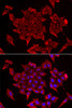 Cell Biology Antibodies 4 Anti-TIMM17A Antibody CAB13578