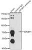 Epigenetics and Nuclear Signaling Antibodies 1 Anti-IGF2BP1 Antibody CAB13581