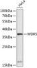 Epigenetics and Nuclear Signaling Antibodies 1 Anti-WDR5 Antibody CAB13582