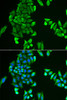 Cell Biology Antibodies 4 Anti-ACSS2 Antibody CAB13596