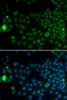 Cell Cycle Antibodies 1 Anti-SPDYA Antibody CAB13607