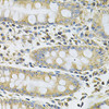 Signal Transduction Antibodies 1 Anti-SERPINA6 Antibody CAB13609