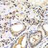 Cell Biology Antibodies 4 Anti-PSME2 Antibody CAB13631