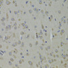 Cell Biology Antibodies 4 Anti-RPL9 Antibody CAB13632