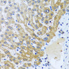 Cell Biology Antibodies 4 Anti-CPA6 Antibody CAB13644