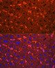 Cell Biology Antibodies 4 Anti-Ceruloplasmin Antibody CAB13660