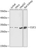 Signal Transduction Antibodies 1 Anti-CLIC1 Antibody CAB13684