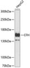 Immunology Antibodies 1 Anti-CFH Antibody CAB13686