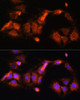 Cell Biology Antibodies 4 Anti-GCSH Antibody CAB13695