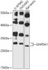 Metabolism Antibodies 1 Anti-GNPDA1 Antibody CAB13717