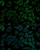 Metabolism Antibodies 1 Anti-IDH3B Antibody CAB13742