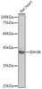 Metabolism Antibodies 1 Anti-IDH3B Antibody CAB13742