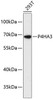 Cell Biology Antibodies 4 Anti-P4HA3 Antibody CAB13767
