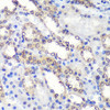 Developmental Biology Anti-PSME4 Antibody CAB13815