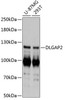 Cell Biology Antibodies 4 Anti-DLGAP2 Antibody CAB13818