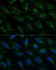 KO Validated Antibodies 1 Anti-NDUFB4 Antibody CAB13820KO Validated