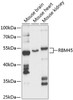 Developmental Biology Anti-RBM45 Antibody CAB13843