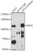 KO Validated Antibodies 1 Anti-EZH2 Antibody CAB13867KO Validated