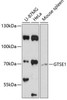 Cell Biology Antibodies 4 Anti-GTSE1 Antibody CAB13903