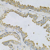 Metabolism Antibodies 1 Anti-APRT Antibody CAB13946