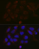 Cell Biology Antibodies 4 Anti-GALNT3 Antibody CAB13985