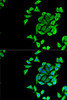 Signal Transduction Antibodies 1 Anti-KCNN3 Antibody CAB14012