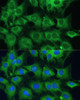 Autophagy Antibodies Anti-PTPN22 Antibody CAB1406