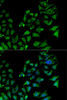 Signal Transduction Antibodies 1 Anti-AIPL1 Antibody CAB14113