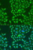 Signal Transduction Antibodies 1 Anti-STAU2 Antibody CAB14117