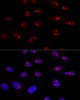 Cell Biology Antibodies 4 Anti-NOP58 Antibody CAB14129