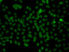 Metabolism Antibodies 1 Anti-PLCXD2 Antibody CAB14164