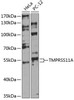Cell Cycle Antibodies 1 Anti-TMPRSS11A Antibody CAB14167