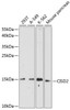 Autophagy Antibodies Anti-CISD2 Antibody CAB14168