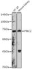 Immunology Antibodies 1 Anti-PRKCZ Antibody CAB14178
