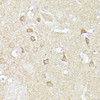 Cell Biology Antibodies 4 Anti-CX3CL1 Antibody CAB14198