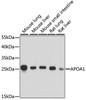 Metabolism Antibodies 1 Anti-APOA1 Antibody CAB14211