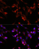 Metabolism Antibodies 1 Anti-UBIAD1 Antibody CAB14214