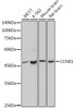 Cell Cycle Antibodies 1 Anti-Cyclin E1 Antibody CAB14225