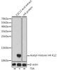 Cell Biology Antibodies 4 Anti-Acetyl-Histone H4-K12 Antibody CAB14227