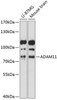 Cell Biology Antibodies 4 Anti-ADAM11 Antibody CAB14249