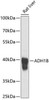 Cell Biology Antibodies 4 Anti-ADH1B Antibody CAB1431