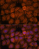 Cell Biology Antibodies 4 Anti-NDUFAF4 Antibody CAB14345